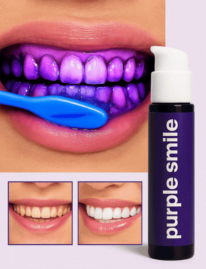 PURPLE SMILE - OPTIENE LA SONRISA QUE SIEMPRE SOÑASTE