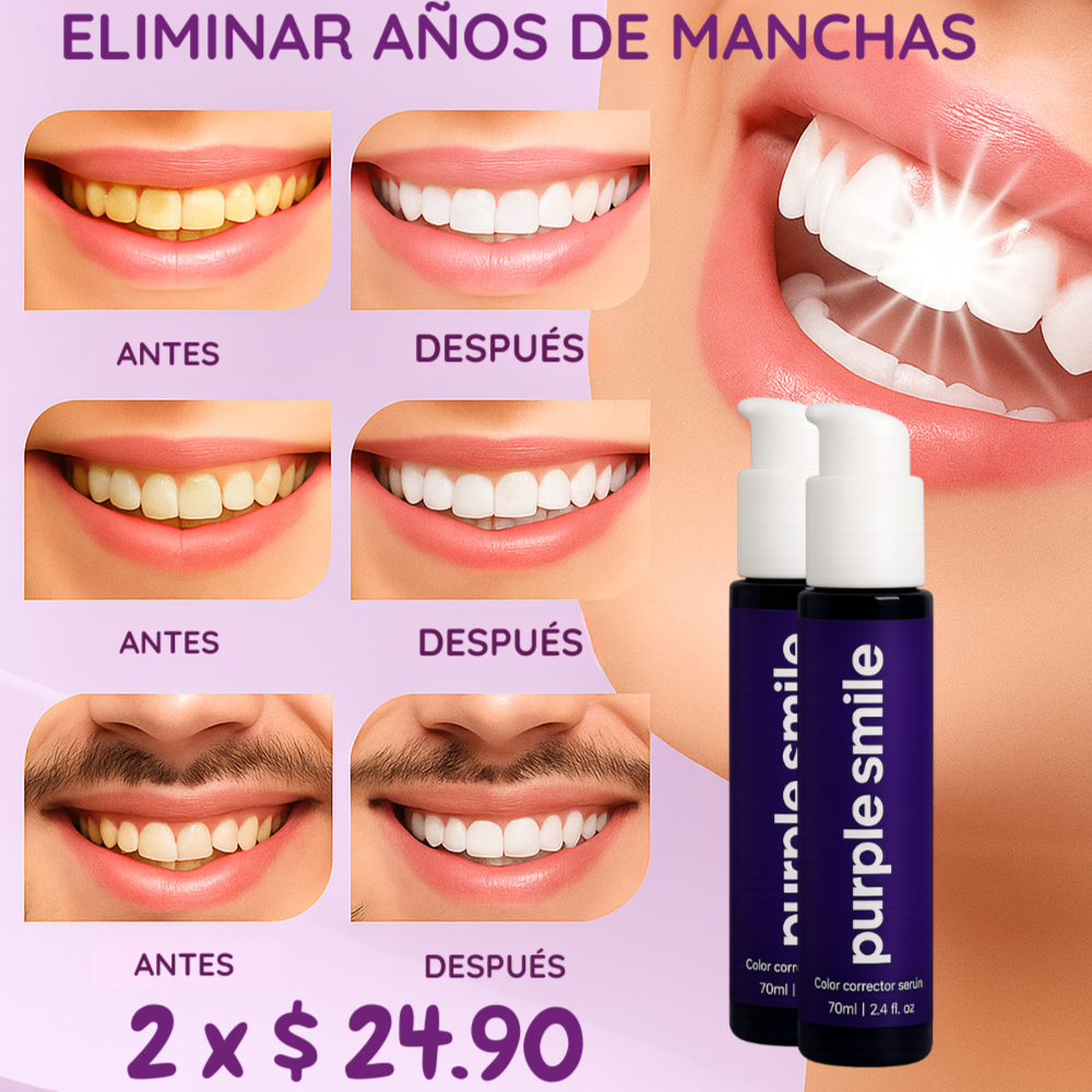 PURPLE SMILE - OPTIENE LA SONRISA QUE SIEMPRE SOÑASTE